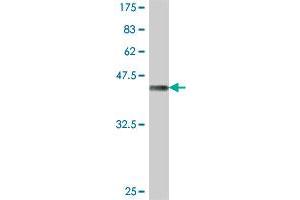 Western Blot detection against Immunogen (38. (CTHRC1 抗体  (AA 32-141))