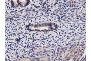 Image no. 9 for anti-Acyl-CoA Thioesterase 12 (ACOT12) antibody (ABIN1496414) (ACOT12 抗体)