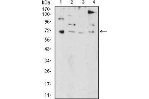 Western Blotting (WB) image for anti-PR Domain Containing 5 (PRDM5) (AA 1-100) antibody (ABIN5874500) (PRDM5 抗体  (AA 1-100))