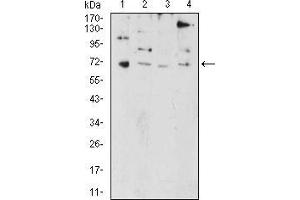 Western Blotting (WB) image for anti-PR Domain Containing 5 (PRDM5) (AA 1-100) antibody (ABIN5874500) (PRDM5 抗体  (AA 1-100))