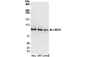 Western Blotting (WB) image for anti-Leucine-Rich Repeats and Calponin Homology (CH) Domain Containing 1 (LRCH1) (AA 375-425) antibody (ABIN7450422)
