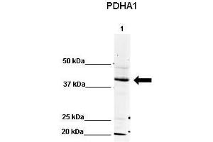 WB Suggested Anti-PDHA1 Antibody    Positive Control:  Lane 1: 80ug mouse brain extract   Primary Antibody Dilution :   1:500  Secondary Antibody :  IRDye 800 CW goat anti-rabbit from Li-COR Bioscience  Secondry Antibody Dilution :   1:20,000  Submitted by:  Dr. (PDHA1 抗体  (N-Term))