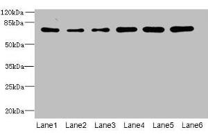 Western blot All lanes: ZNF555 antibody at 2 μg/mL Lane 1: HepG2 whole cell lysate Lane 2: 293T whole cell lysate Lane 3: Hela whole cell lysate Lane 4: Jurkat whole cell lysate Lane 5: Mouse liver tissue Lane 6: HL60 whole cell lysate Secondary Goat polyclonal to rabbit IgG at 1/10000 dilution Predicted band size: 74, 64, 73 kDa Observed band size: 74 kDa (ZNF555 抗体  (AA 1-200))