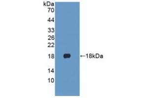 Detection of Recombinant KRT1, Human using Polyclonal Antibody to Cytokeratin 1 (CK1) (Cytokeratin 1 抗体  (AA 487-644))