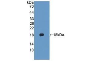 Detection of Recombinant KRT1, Human using Polyclonal Antibody to Cytokeratin 1 (CK1)