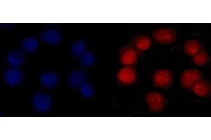 IF analysis of MSH2 using anti-MSH2 antibody (ABIN7601369). (MSH2 抗体  (AA 337-583))