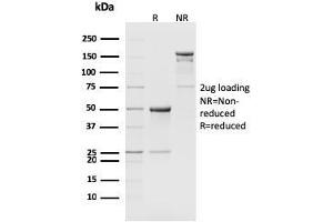 SDS-PAGE Analysis Purified CD8b Rat Monoclonal Antibody (H35-17. (CD8B 抗体)