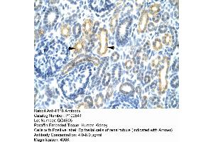 Human kidney (IRF8 抗体  (N-Term))