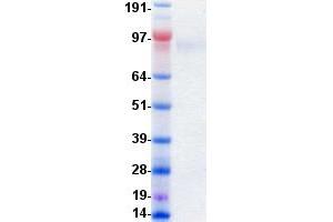 Validation with Western Blot