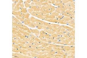 Immunohistochemistry of paraffin embedded mouse heart using Junctophilin2 (ABIN7074393) at dilution of 1: 600 (400x lens) (Junctophilin 2 抗体)