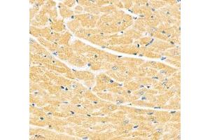 Immunohistochemistry of paraffin embedded mouse heart using Junctophilin2 (ABIN7074393) at dilution of 1: 600 (400x lens) (Junctophilin 2 抗体)