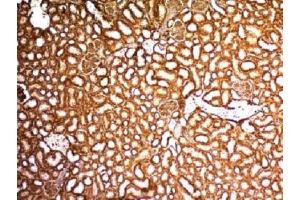 IHC testing of FFPE mouse kidney with WT1 antibody. (WT1 抗体)