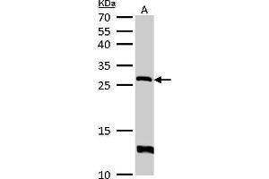 WB Image HPRT antibody detects HPRT1 protein by Western blot analysis. (HPRT1 抗体)