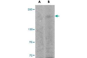 Western blot analysis of SIPA1L1 in rat brain tissue lysate with SIPA1L1 polyclonal antibody  at (A) 0. (SIPA1L1 抗体  (N-Term))