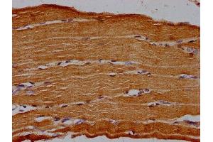 Immunohistochemistry (IHC) image for anti-5'-Nucleotidase, Ecto (CD73) (NT5E) (AA 32-264) antibody (ABIN7142671)