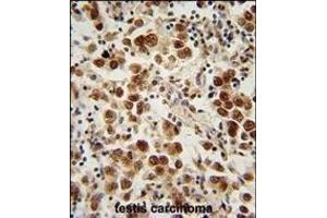 Immunohistochemistry (Paraffin-embedded Sections) (IHC (p)) image for anti-Spermatogenesis and Oogenesis Specific Basic Helix-Loop-Helix 1 (SOHLH1) (AA 40-68), (N-Term) antibody (ABIN654873)