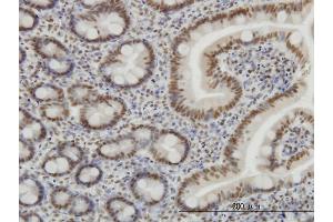 Immunoperoxidase of monoclonal antibody to SP1 on formalin-fixed paraffin-embedded human small Intestine. (SP1 抗体  (AA 89-198))