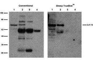 Sheep TrueBlot® IP / Western Blot: Jurkat cell lysate (500 µg) was incubated with 2 µg of sheep anti-SLP76 and immunoprecipitated using Protein G. (绵羊 TrueBlot® Anti-绵羊 IgG HRP)