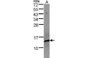 WB Image Sample(30 μg of whole cell lysate) A:Raji , 15% SDS PAGE antibody diluted at 1:500 (beta-2 Microglobulin 抗体)