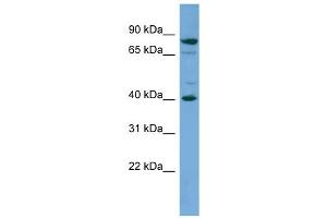 WB Suggested Anti-PNMA2 Antibody Titration: 0. (PNMA2 抗体  (Middle Region))