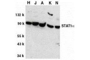 Western blot analysis of STAT1 alpha in whole cell lysates from HeLa (H), Jurkat (J), A431 (A), K562 (K), and NIH3T3 (N) cells, with this product at 1 μg/ml. (STAT1 抗体  (C-Term))