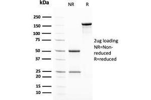 SDS-PAGE Analysis Purified Insulin Mouse Monoclonal Antibody (2D11-H5). (Insulin 抗体)
