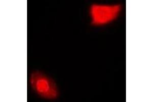 Immunofluorescent analysis of SGTA staining in MCF7 cells. (SGTA 抗体)