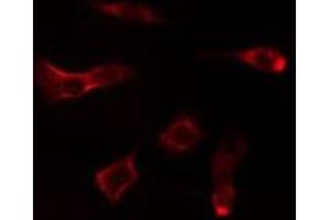 ABIN6275047 staining MCF7 cells by IF/ICC.