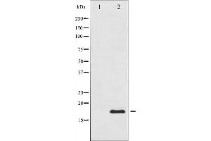 Western blot analysis of Acetyl-Histone H3 phosphorylation expression in TSA treated RAW264. (Histone 3 抗体  (H3K9ac))