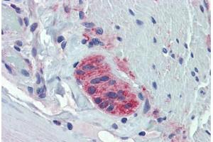 Human Small Intestine, Myenteric Plexus: Formalin-Fixed, Paraffin-Embedded (FFPE) (TUBB2A 抗体  (AA 254-303))