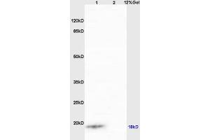 Lane 1: human colon carcinoma lysates Lane 2: mouse intestine lysates probed with Anti IQCJ Polyclonal Antibody, Unconjugated (ABIN1387803) at 1:200 in 4 °C. (IQCJ 抗体  (AA 47-67))
