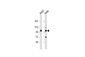 All lanes : Anti-IGF1 Receptor (IGF1R) Antibody (C-term) at 1:2000 dilution Lane 1: A431 whole cell lysate Lane 2: Hela whole cell lysate Lysates/proteins at 20 μg per lane. (IGF1R 抗体  (C-Term))