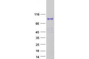 TIAM2 Protein (Transcript Variant 2) (Myc-DYKDDDDK Tag)