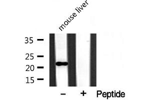 Western blot analysis of extracts from mouse liver, using BST2 antibody. (BST2 抗体  (Internal Region))