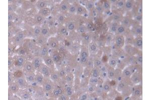 DAB staining on IHC-P; Samples: Mouse Liver Tissue (GCDH 抗体  (AA 270-438))