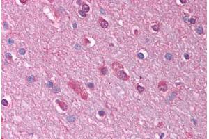 Human Brain, Cortex (formalin-fixed, paraffin-embedded) stained with GABRQ antibody ABIN214762 at 2. (GABRQ 抗体  (AA 31-80))