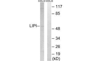 Western Blotting (WB) image for anti-Lipase I (LIPI) (Internal Region) antibody (ABIN1851490) (Lipase I 抗体  (Internal Region))