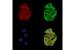 ABIN7096999 and ABIN7101066 staining Hela cells by IF/ICC. (CCDC43 抗体)