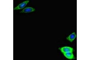 Immunofluorescent analysis of HepG2 cells using ABIN7174280 at dilution of 1:100 and Alexa Fluor 488-congugated AffiniPure Goat Anti-Rabbit IgG(H+L) (USP2 抗体  (AA 9-265))
