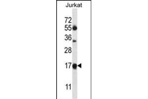 MRPL41 Antibody (N-term) (ABIN657049 and ABIN2846216) western blot analysis in Jurkat cell line lysates (35 μg/lane). (MRPL41 抗体  (N-Term))