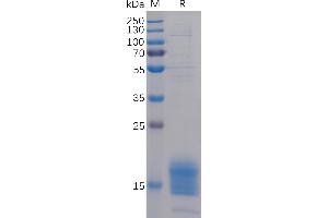 Human TIGIT Protein, His Tag on SDS-PAGE under reducing condition.