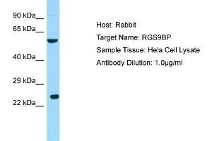 Host: RabbitTarget Name: RGS9BPAntibody Dilution: 1. (Regulator of G Protein Signaling 9 Binding Protein (RGS9BP) (N-Term) 抗体)
