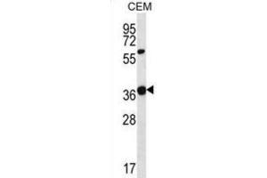 Western Blotting (WB) image for anti-Wingless-Type MMTV Integration Site Family, Member 16 (WNT16) antibody (ABIN2997219) (WNT16 抗体)
