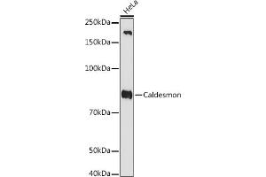 Western blot analysis of extracts of HeLa cells, using Caldesmon antibody (ABIN7266024) at 1:1000 dilution. (Caldesmon 抗体)