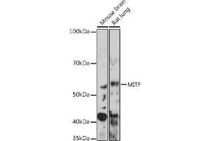 Western blot analysis of extracts of various cell lines, using MITF Rabbit mAb (ABIN7268511) at 1:1000 dilution. (MITF 抗体)