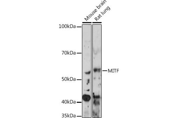 MITF 抗体