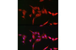 Immunofluorescence analysis of NIH-3T3 cells using TRIM31 Rabbit pAb (ABIN7270987) at dilution of 1:200 (40x lens). (TRIM31 抗体  (AA 186-425))