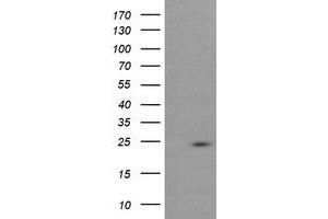 Image no. 2 for anti-RAB37, Member RAS Oncogene Family (RAB37) antibody (ABIN1500565) (RAB37 抗体)