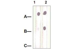Dot Blot : 1 ug peptide was blot onto NC membrane. (Neuropilin 1 抗体  (pThr916))