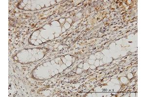 Immunoperoxidase of monoclonal antibody to MAPRE2 on formalin-fixed paraffin-embedded human colon. (MAPRE2 抗体  (AA 1-62))